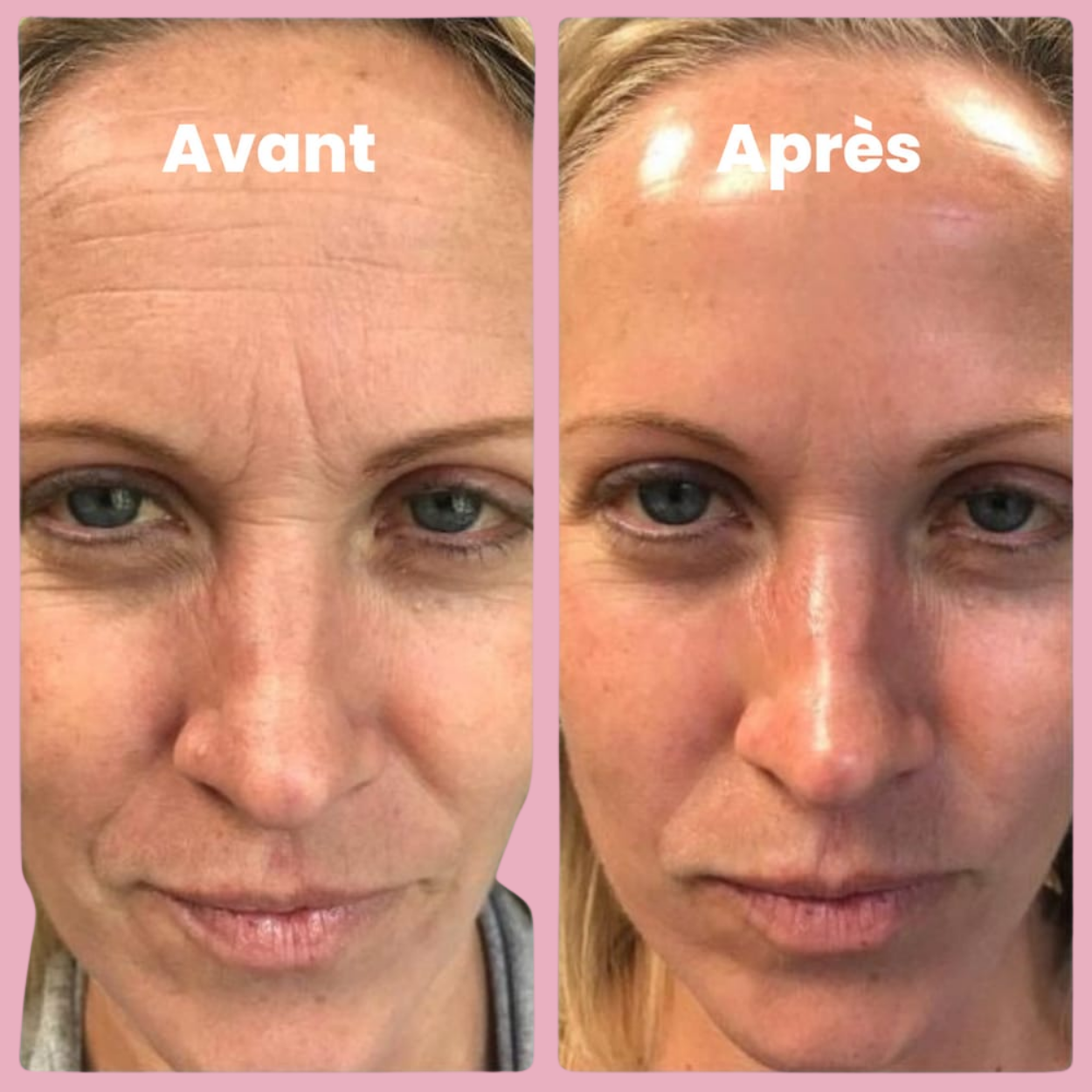 Masque au Bio-Collagène (3 pcs)
