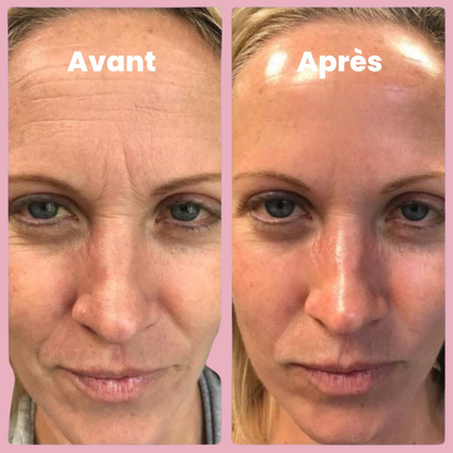 Masque au Bio-Collagène (3 pcs)